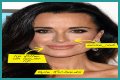Botox, Implants & More! – Hollywood Life